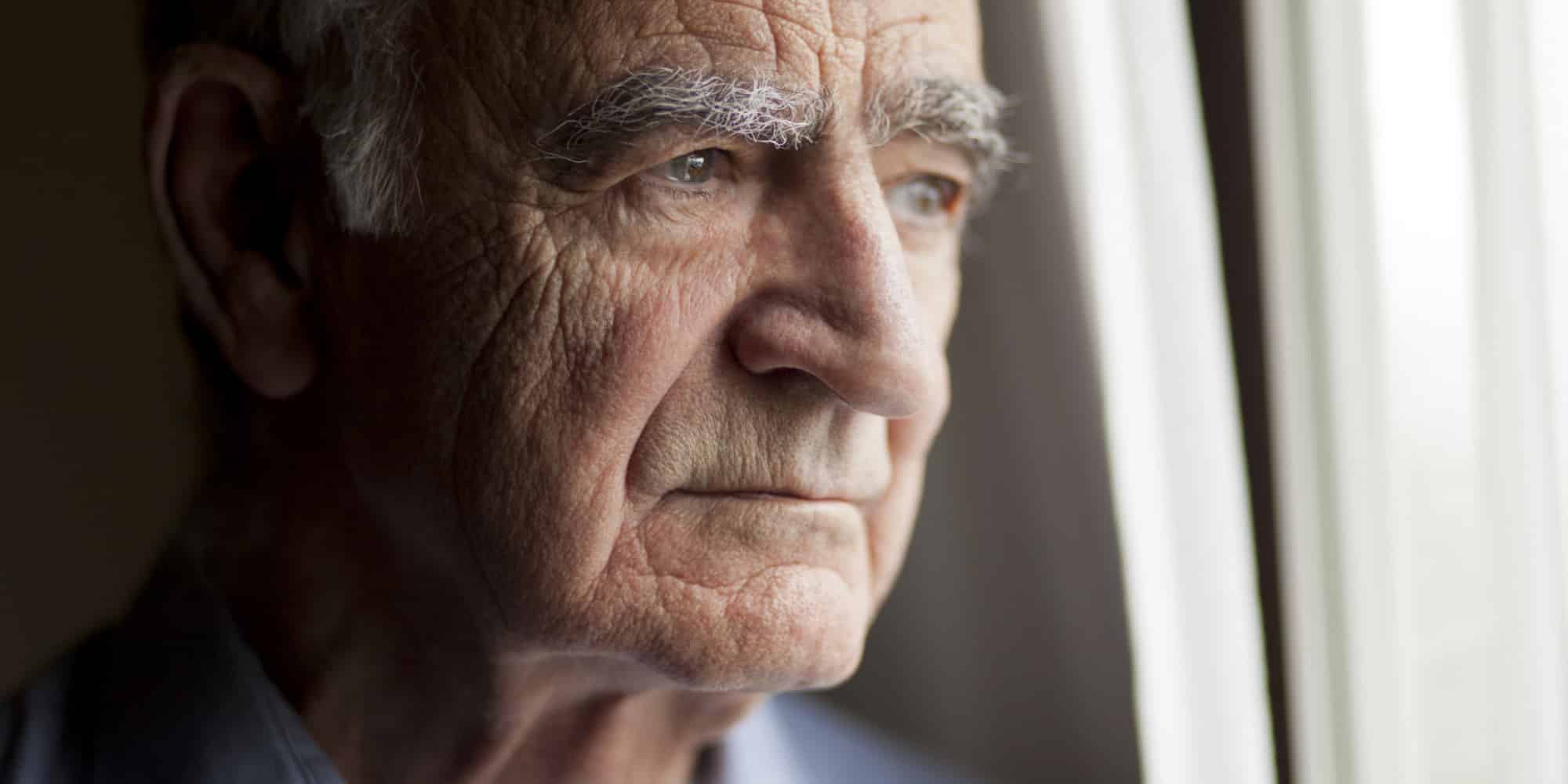 Alzheimer definición, causas, síntomas y tratamientos para ésta demencia